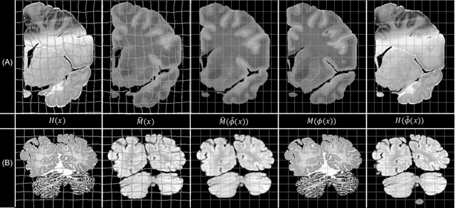 Figure 3 for Synth-by-Reg (SbR): Contrastive learning for synthesis-based registration of paired images