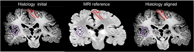 Figure 4 for Synth-by-Reg (SbR): Contrastive learning for synthesis-based registration of paired images