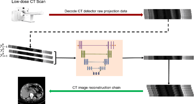 Figure 1 for Low-dose CT reconstruction by self-supervised learning in the projection domain