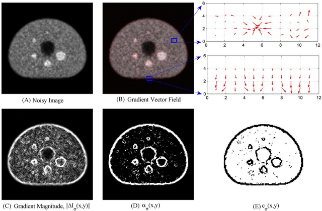 Figure 1 for Positron Emission Tomography (PET) image enhancement using a gradient vector orientation based nonlinear diffusion filter (GVOF) for accurate quantitation of radioactivity concentration