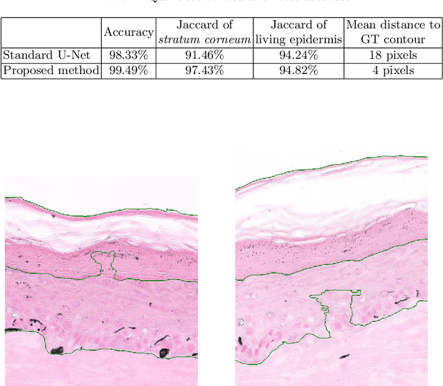 Figure 2 for Dealing with Topological Information within a Fully Convolutional Neural Network