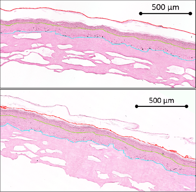 Figure 1 for Dealing with Topological Information within a Fully Convolutional Neural Network