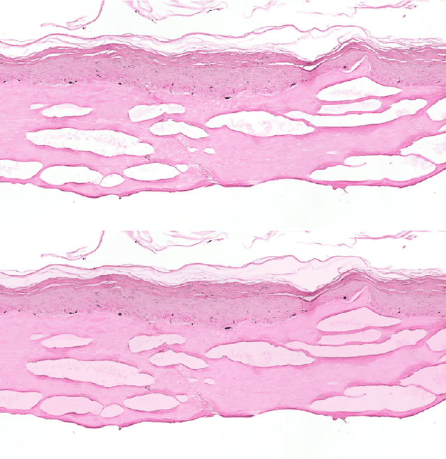 Figure 4 for Dealing with Topological Information within a Fully Convolutional Neural Network