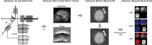Figure 3 for An overview of deep learning in medical imaging focusing on MRI