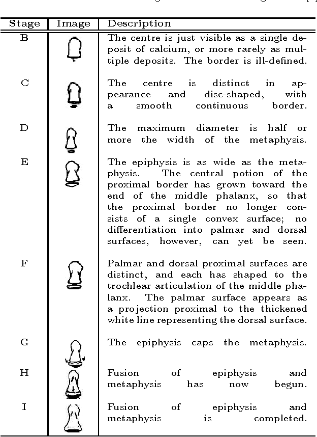 Figure 1 for Predictive Modelling of Bone Age through Classification and Regression of Bone Shapes