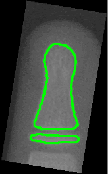 Figure 2 for Predictive Modelling of Bone Age through Classification and Regression of Bone Shapes