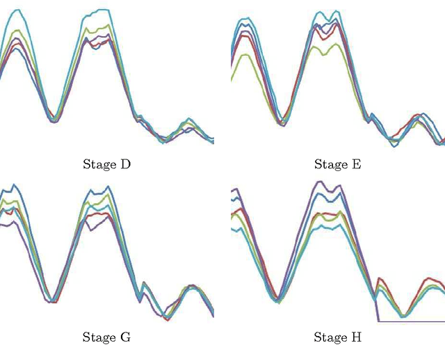 Figure 4 for Predictive Modelling of Bone Age through Classification and Regression of Bone Shapes