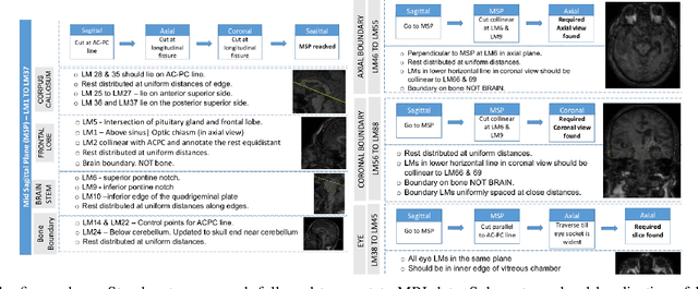 Figure 2 for Simulating Realistic MRI variations to Improve Deep Learning model and visual explanations using GradCAM