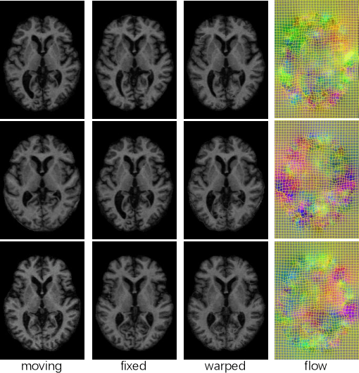 Figure 2 for Deformable Registration of Brain MR Images via a Hybrid Loss