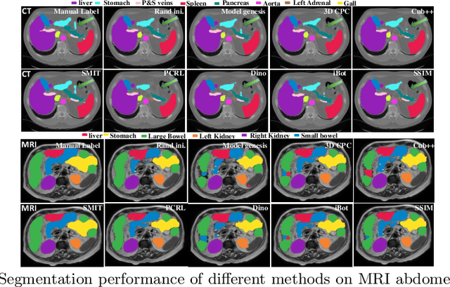 Figure 3 for Self-supervised 3D anatomy segmentation using self-distilled masked image transformer (SMIT)