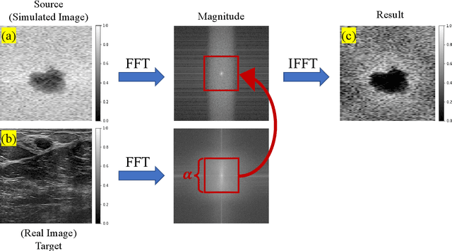 Figure 1 for Ultrasound Domain Adaptation Using Frequency Domain Analysis
