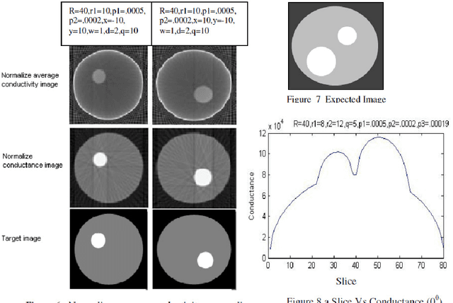 Figure 4 for Implementation of Radon Transformation for Electrical Impedance Tomography (EIT)