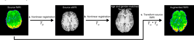 Figure 1 for Anatomically-Informed Data Augmentation for functional MRI with Applications to Deep Learning