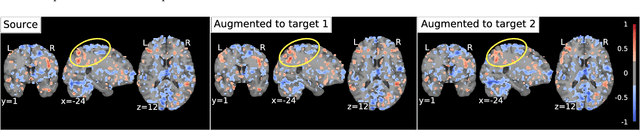 Figure 2 for Anatomically-Informed Data Augmentation for functional MRI with Applications to Deep Learning