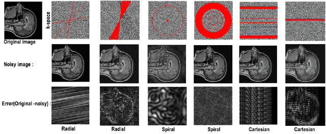 Figure 3 for Which K-Space Sampling Schemes is good for Motion Artifact Detection in Magnetic Resonance Imaging?