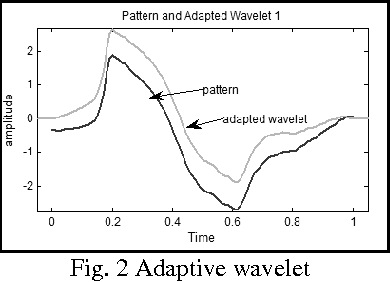 Figure 2 for Adaptive Wavelet Based Identification and Extraction of PQRST Combination in Randomly Stretching ECG Sequence
