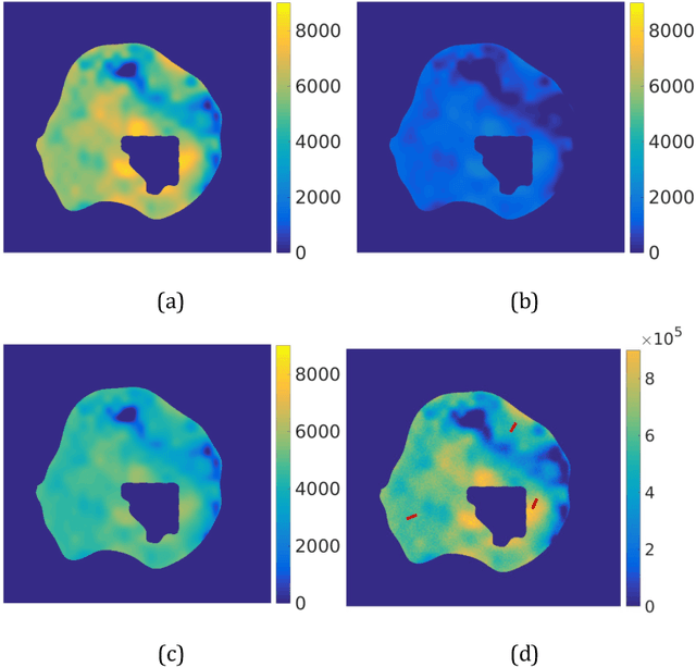 Figure 3 for Diffusion-weighted MRI-guided needle biopsies permit quantitative tumor heterogeneity assessment and cell load estimation