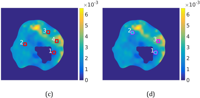 Figure 4 for Diffusion-weighted MRI-guided needle biopsies permit quantitative tumor heterogeneity assessment and cell load estimation