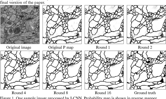 Figure 1 for An Iterative Convolutional Neural Network Algorithm Improves Electron Microscopy Image Segmentation