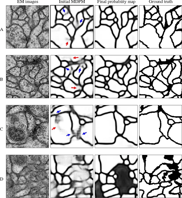 Figure 3 for An Iterative Convolutional Neural Network Algorithm Improves Electron Microscopy Image Segmentation