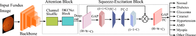 Figure 3 for Discriminative Kernel Convolution Network for Multi-Label Ophthalmic Disease Detection on Imbalanced Fundus Image Dataset