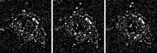 Figure 2 for Automatic tracking of protein vesicles