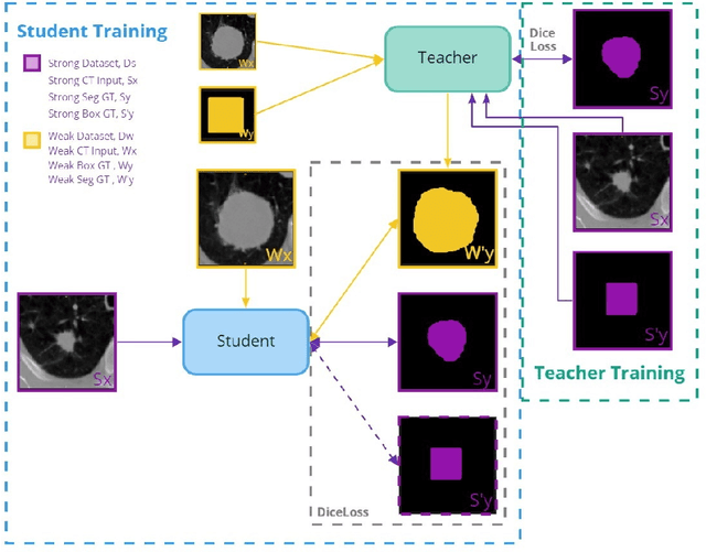 Figure 1 for Teacher-Student Architecture for Mixed Supervised Lung Tumor Segmentation