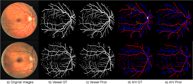 Figure 3 for Fully Automated Tree Topology Estimation and Artery-Vein Classification