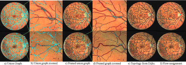 Figure 4 for Fully Automated Tree Topology Estimation and Artery-Vein Classification