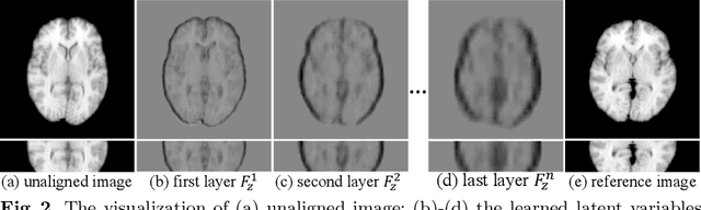 Figure 3 for Probabilistic Multilayer Regularization Network for Unsupervised 3D Brain Image Registration