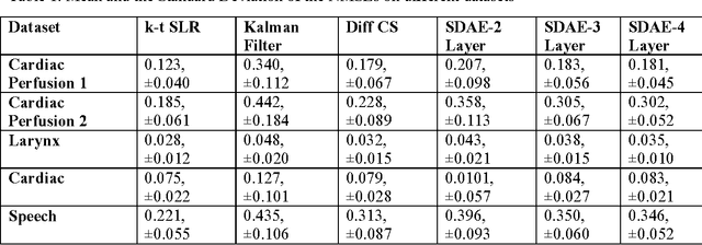 Figure 3 for Real-time Dynamic MRI Reconstruction using Stacked Denoising Autoencoder