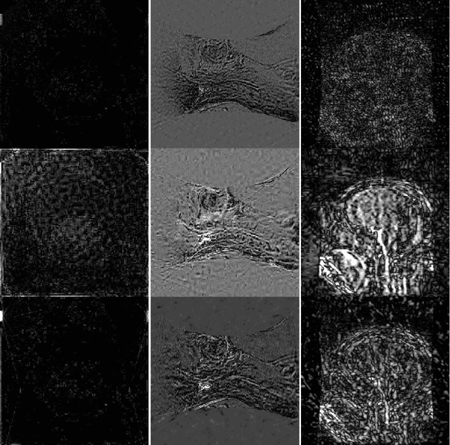 Figure 4 for Real-time Dynamic MRI Reconstruction using Stacked Denoising Autoencoder