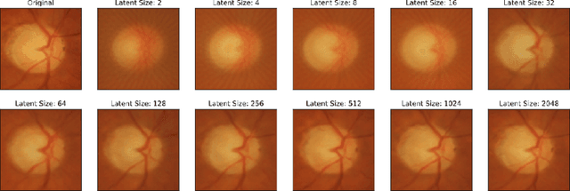 Figure 4 for Assessing glaucoma in retinal fundus photographs using Deep Feature Consistent Variational Autoencoders