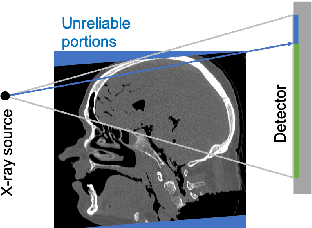 Figure 2 for Motion Correction via Locally Linear Embedding for Helical Photon-counting CT