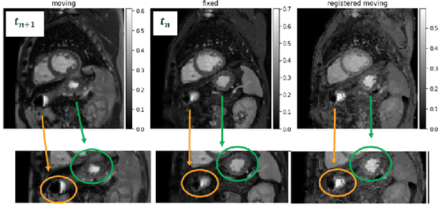 Figure 3 for Deep-Learning based Motion Correction for Myocardial T1 Mapping