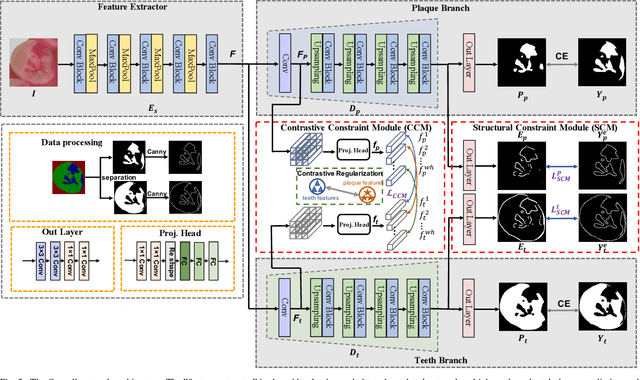 Figure 2 for Semantic decomposition Network with Contrastive and Structural Constraints for Dental Plaque Segmentation