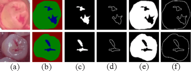 Figure 3 for Semantic decomposition Network with Contrastive and Structural Constraints for Dental Plaque Segmentation