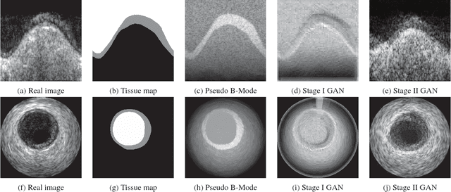 Figure 3 for Simulating Patho-realistic Ultrasound Images using Deep Generative Networks with Adversarial Learning