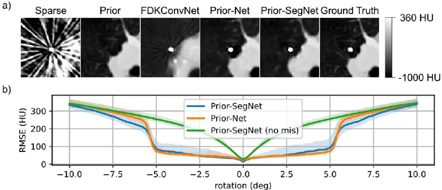 Figure 1 for Dual Branch Prior-SegNet: CNN for Interventional CBCT using Planning Scan and Auxiliary Segmentation Loss