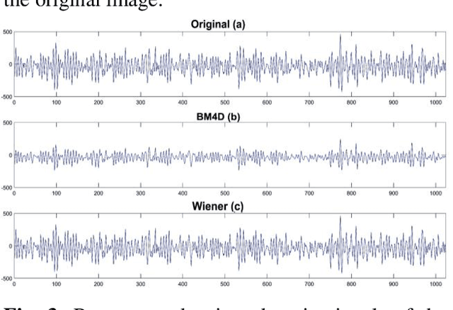 Figure 3 for Image denoising in acoustic field microscopy