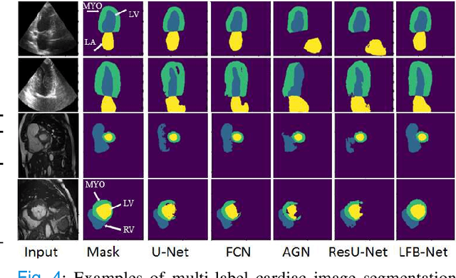 Figure 4 for Learning With Context Feedback Loop for Robust Medical Image Segmentation