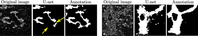 Figure 1 for Semi-supervised, Topology-Aware Segmentation of Tubular Structures from Live Imaging 3D Microscopy