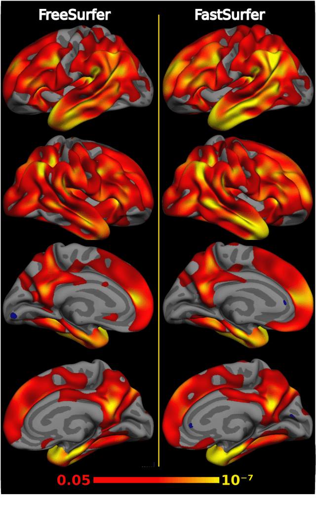 Figure 4 for FastSurfer -- A fast and accurate deep learning based neuroimaging pipeline