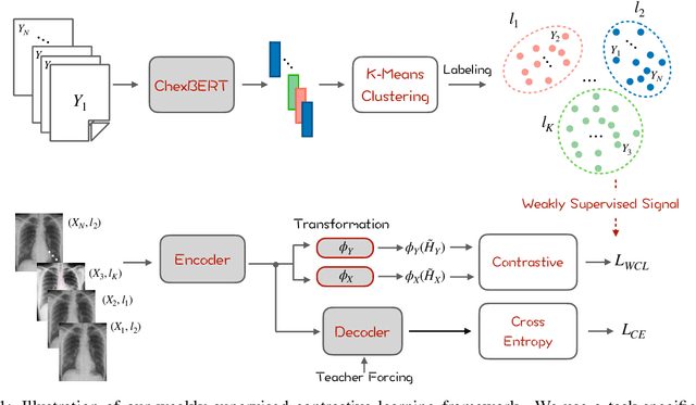Figure 1 for Weakly Supervised Contrastive Learning for Chest X-Ray Report Generation