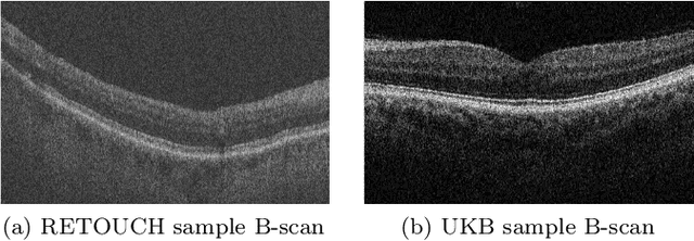 Figure 1 for Domain Adaptation via CycleGAN for Retina Segmentation in Optical Coherence Tomography