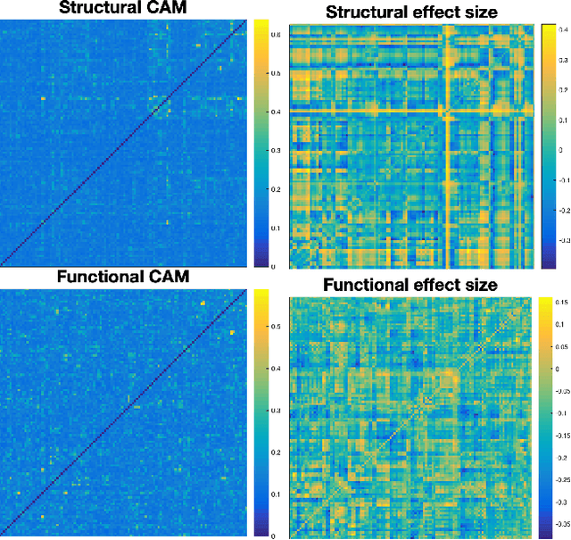 Figure 4 for Single-participant structural connectivity matrices lead to greater accuracy in classification of participants than function in autism in MRI