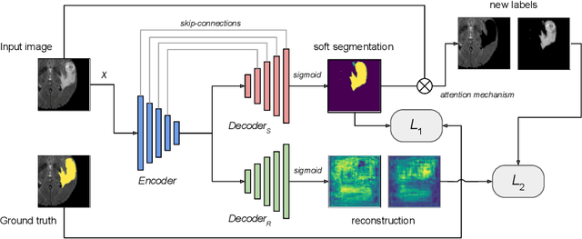 Figure 1 for Multi-Task Attention-Based Semi-Supervised Learning for Medical Image Segmentation