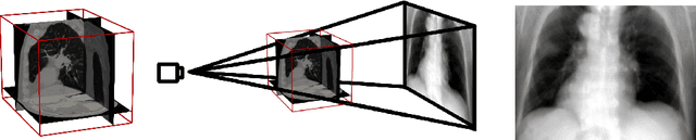 Figure 2 for Real-Time Patient-Specific Lung Radiotherapy Targeting using Deep Learning