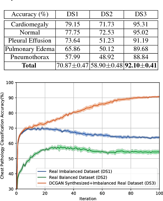 Figure 2 for Generalization of Deep Neural Networks for Chest Pathology Classification in X-Rays Using Generative Adversarial Networks