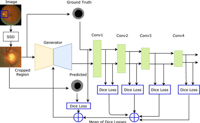 Figure 3 for REFUGE CHALLENGE 2018-Task 2:Deep Optic Disc and Cup Segmentation in Fundus Images Using U-Net and Multi-scale Feature Matching Networks